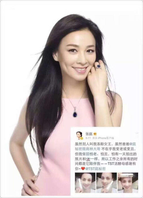 张庭.jpg