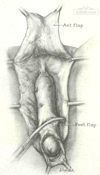SRSFig4.jpg